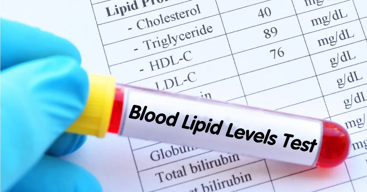 blood lipid levels