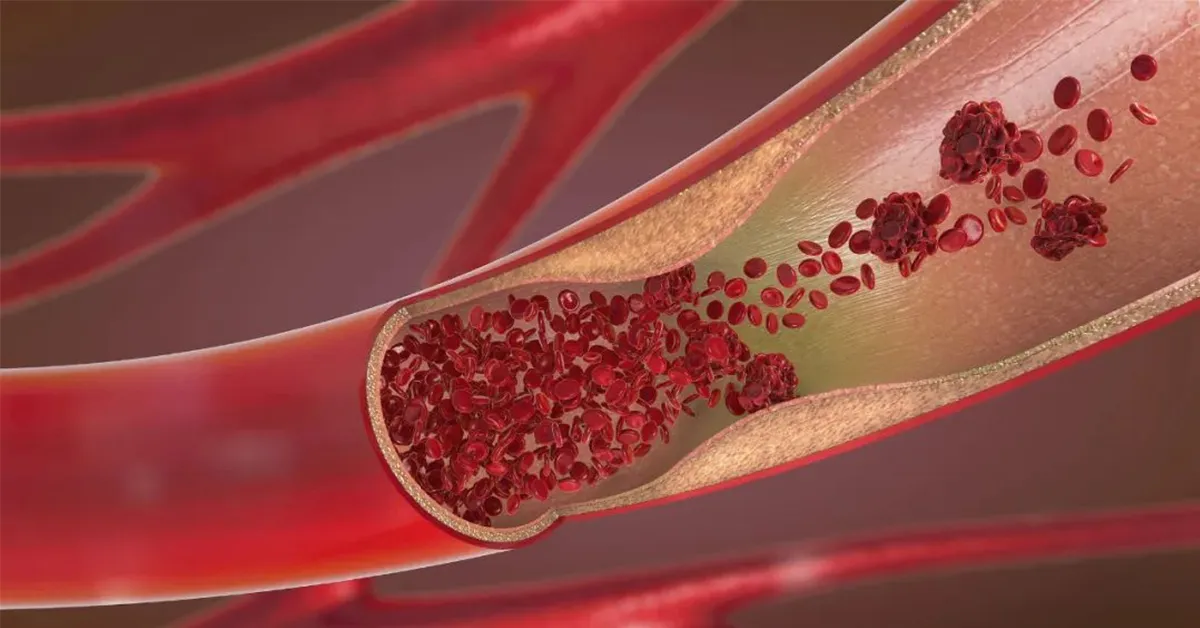 blood lipid levels